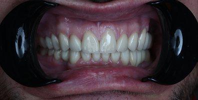 Пример работы