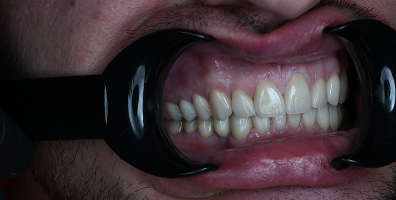 Пример работы